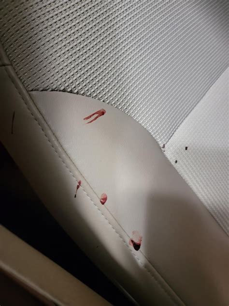 The aftermath of my wife giving birth in the car. Baby and  .